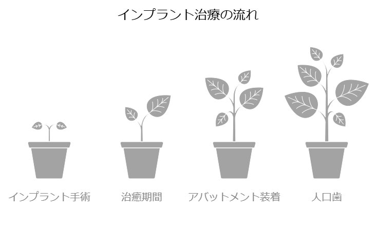 インプラント治療の流れ