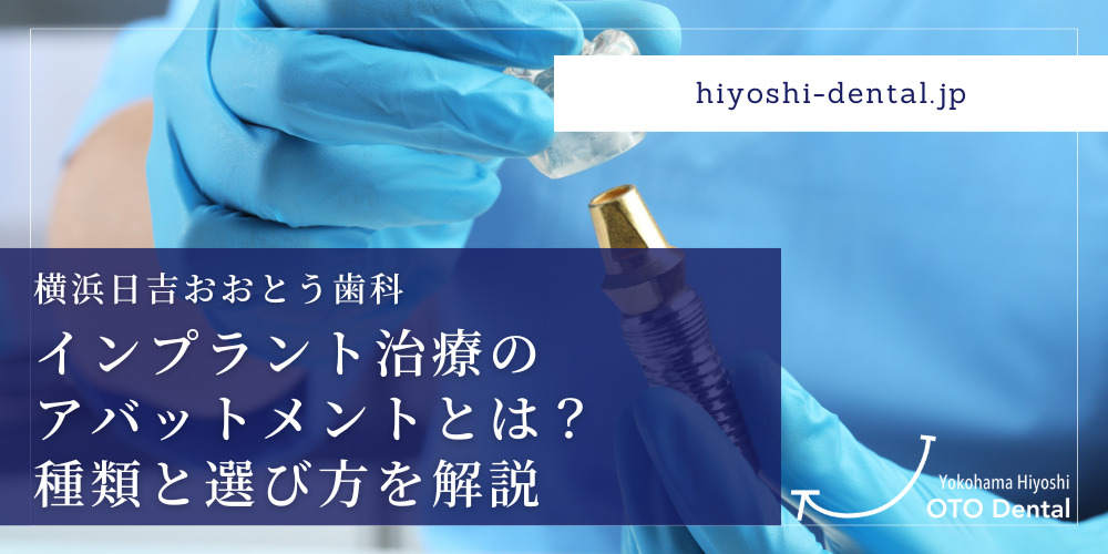 インプラント治療のアバットメントとは？種類と選び方を解説