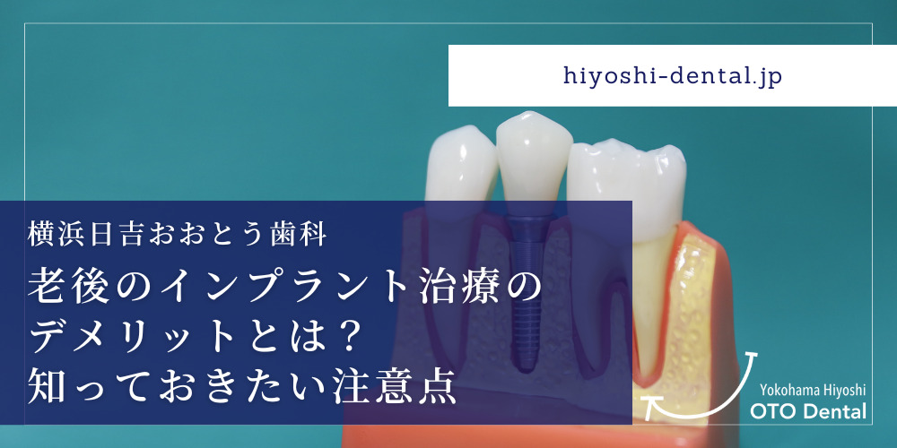 老後のインプラント治療のデメリットとは？知っておきたい注意点