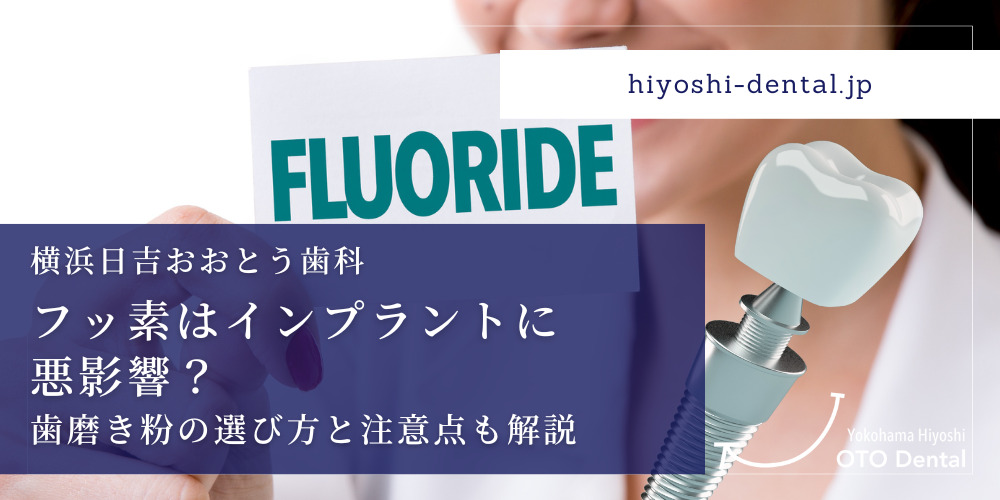 フッ素はインプラントに-悪影響？歯磨き粉の選び方と注意点も解説