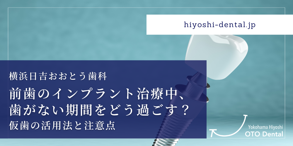 前歯のインプラント治療中、歯がない期間をどう過ごす？仮歯の活用法と注意点