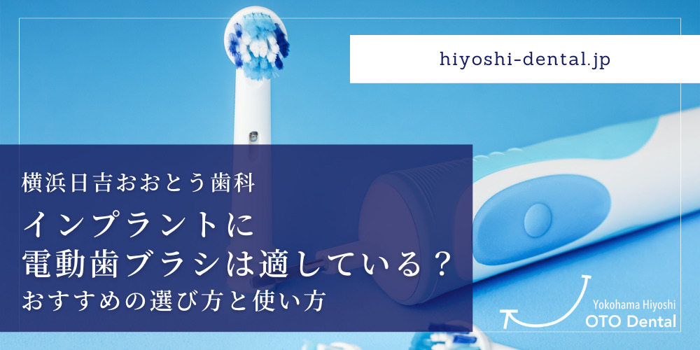 インプラントに電動歯ブラシは適している？おすすめの選び方と使い方