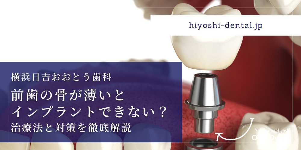 前歯の骨が薄いとインプラントできない？治療法と対策を徹底解説